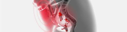 Obstetrical Hemorrhage: Types and Management